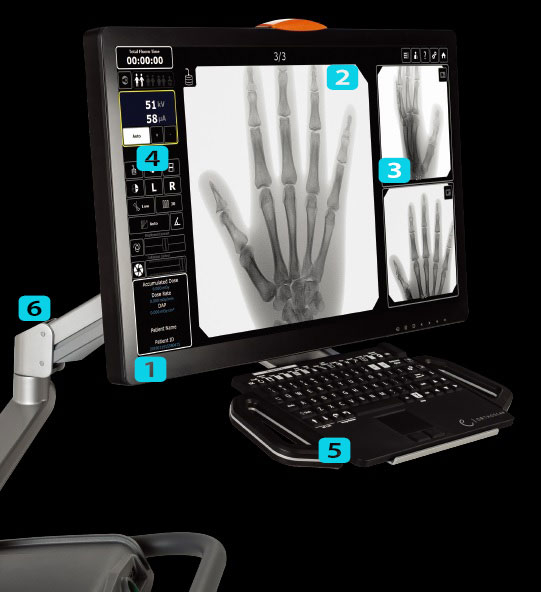 orthoscan-fd-pulse-screen_1.jpg